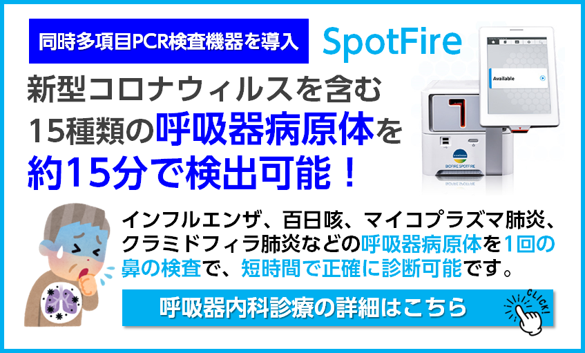 spotfire